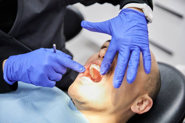 Best Emergency Root Canal Treatment in Lliams Bay, WI