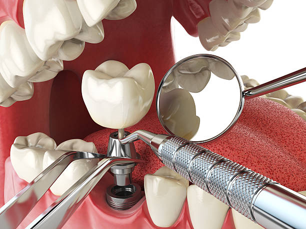 Best Broken or Cracked Tooth Emergency Dentist in Lliams Bay, WI